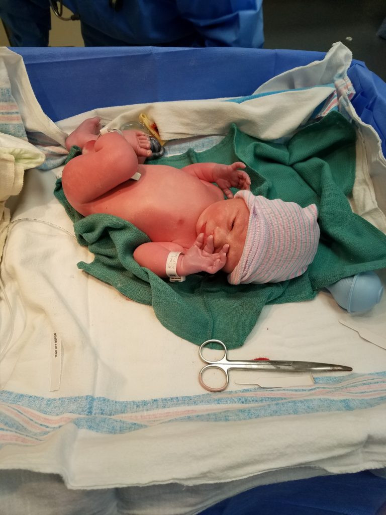 birth story, preemie, nicu